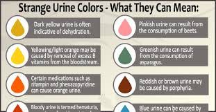 51 All Inclusive Abnormal Urine Color Chart