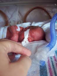 During these period the babies continue growing with every passing day. Preterm Birth Wikipedia