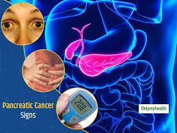 If you've been diagnosed with pancreatic cancer, ask your doctor which type you have. You Should Never Ignore These Warning Signs Of Pancreatic Cancer