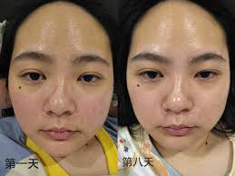 ✨ 第一次体验，就被惊艳到✨ 从朋友圈看到一位美女的敏感肌改善了，就来尝试一下～ 今天终于开箱了这套护肤品， 颜值高到我舍不到开耶～ 😝  我用的第一感觉就是——质地很细腻！😍 涂抹在肌肤上很快就吸收，整个过程像在做SPA一样享受💆‍♀️ 尤其是喷雾，轻轻一喷，皮肤 ...