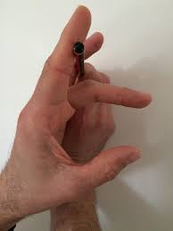 Ask the child to flex the free digit at the pip joint. Guidelines On Managing Hand Injuries For Gp S And Health Professionals Dr Mark Mcgrath