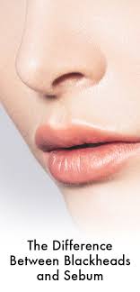 Maybe The Dark Spots On Your Nose Aren T Blackheads At All Here S The Real Deal On Sebaceous Filaments And Sebaceous Filaments Nose Pores Blackheads On Cheeks