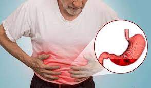 Ở các loài chim và gia cầm, dạ dày gồm có dạ dày cơ và dạ dày tuyến. Ä'au Dáº¡ Day La Gi Nguyen Nhan Triá»‡u Chá»©ng Va Cach Chá»¯a Bá»‡nh Táº¡i Nha