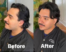 Tips for fixing hairline and volume?