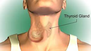 Ung thư tuyến giáp có thể xảy ra với bất cứ độ tuổi nào, tuy nhiên phổ biến nhất ở những đối tượng đang bước sang tuổi 30 và người lớn tuổi. Ung ThÆ° Tuyáº¿n Giap Nguyen Nhan Triá»‡u Chá»©ng Va Cach Ä'iá»u Trá»‹