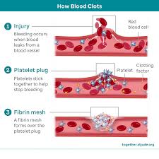 Image result for Platelet Function Closure Time