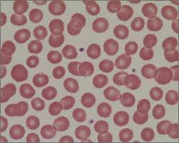 Maybe you would like to learn more about one of these? Gambaran Sel Darah Normal Patologi Klinik