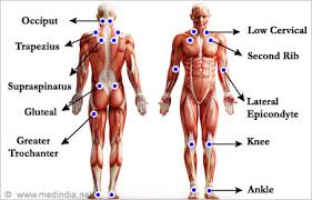 Myofascial Pain Syndrome Causes Risk Factors Symptoms