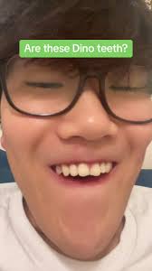 Dino teeth or nah? #dinoteeth #tinytooth #fypage #ginsul