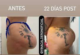 Yina, quien participó en 'protagonistas de nuestra tele' ha dicho que sus papás la hicieron de afán. Yina Calderon Esta Danando Su Propio Cuerpo Vibra