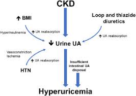 Image result for Hyperuricemia