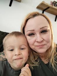 Devastated at the state of my kneecap Alison E Killick