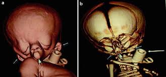 Image result for Dignathia