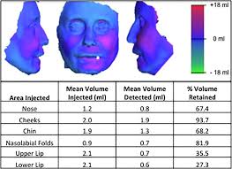 Stem cell-enriched lipotransfer improves facial fibrosis in systemic  sclerosis