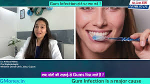 Are you troubled by swollen gums or toothache? See the dentist!