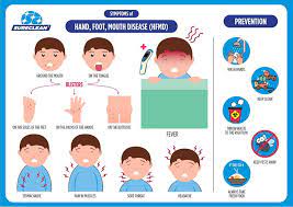 Shekhar k (1), lye ms, norlijah o, ong f, looi lm, khuzaiah r, marzuki i, hussein i, wong sl, mohan j, sinniah m, abu bakar s. Hfmd Hand Foot And Mouth Disease In Raaga Malaysia Facebook