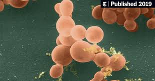 Cats with pancreatic cancer rarely survive more than a few months after the time of diagnosis. In The Pancreas Common Fungi May Drive Cancer The New York Times