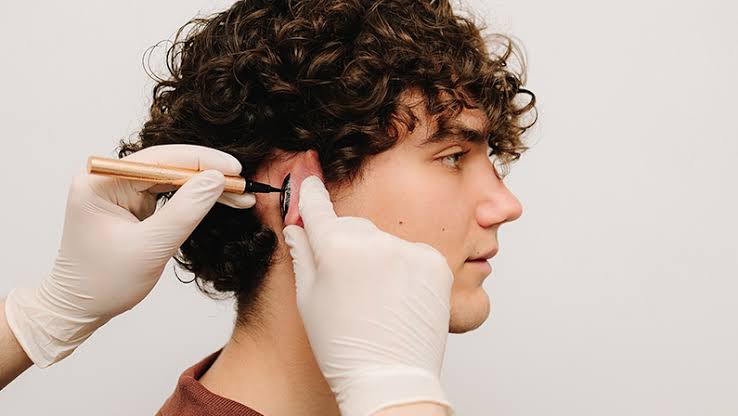 Otoplasty in Dubai | Ear Reshaping Surgery – Dr. Muhammad Jabbr
