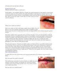 According to the national institutes of health, about 90 percent of adults have been exposed to the virus by age 50. Calameo All About Cold Sores