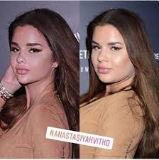 15 Photos That Prove That Everything On Instagram Is A Lie 2 Of 3 Inspire Dot Instagram Vs Real Life Plastic Surgery Sarah Duchess Of York