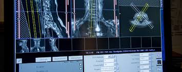 Kopfschmerzen, übelkeit, erbrechen aber auch bewußtseinstrübung, epileptische anfälle und zentrale paresen. Fur Kollegen Innen Loerrach