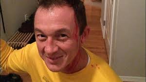 Local runner bloodied by owl attack