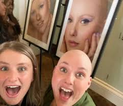 Alopecia: 'I decided I'd had enough of hiding my real self'