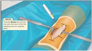 12 Virtual Surgeries You Can Try Your Hands At With Images Health Science Life Science Surgery