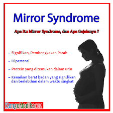 Mirror syndrome refers to an obsession with our reflection and a tendency to distort it in our minds until we see defects or magnify the ones we believe we have. Apa Itu Mirror Syndrome Songo Medika