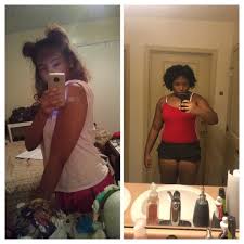 Gained 60 Lbs On Nexplanon Nexplanon
