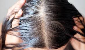 Serum ferritin levels equal to or below 30 ng/ml can lead to hair loss (7). Best Supplements For Hair Growth Protein Zinc And Iron Could Prevent Hair Loss Express Co Uk