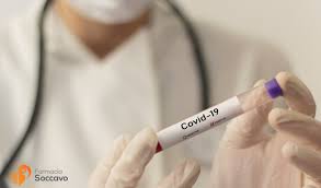 Vivadiag Test Per Coronavirus Come Funziona E Veramente Valido Il Blog Di Farmacia Soccavo