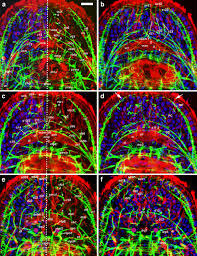 Indicate, using the letters provided, where each muscle group is on the diagram. Neurobiology Of The Basal Platyhelminth Macrostomum Lignano Map And Digital 3d Model Of The Juvenile Brain Neuropile Springerlink