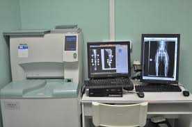 Controle de qualite en radiologie conventionnelle (tp11). Radiologie Numerique