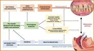 Image result for Taste Dysfunction