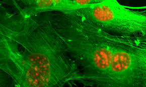 You will plan for higher studies to groom your career. Losing Neurofibromin Is Good News For Breast Cancer