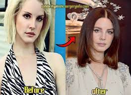 It is all regarding to her appearance which looks so different. Pin Auf Celebrity Plastic Surgery