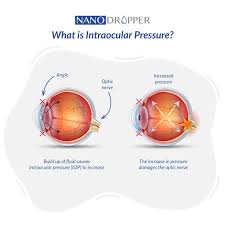 Image result for Intraocular Pressure