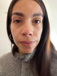 I had a mastectomy and unilateral implant 5 years ago. About 3-4 years ago  I became allergic to ALL eye makeup. I worked with a dermatologist and  tried all the “natural/hypoallergenic” options.