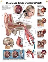 Middle Ear Conditions Chart 20x26 In 2020 Middle Ear Ear Anatomy Pediatric Nursing
