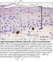 Light Micrograph Of Merkel Cells In The Epidermis Of Thick Skin