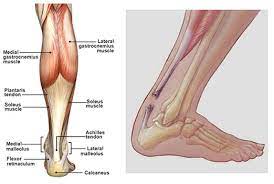 This is in the calf, about two inches above the heel bone. Minimally Invasive Achilles Repair Orthovirginia