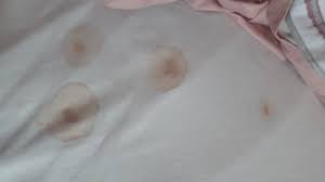 Spermaflecken auf laken, polstern, kleidung oder autositzen polsterreiniger: Was Sind Das Fur Flecken Im Kinderbett Gesundheit Kinder