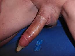 File:Penis in condom - semen in condom (Penis im Kondom - Sperma im Kondom)-02.jpg  - Wikimedia Commons