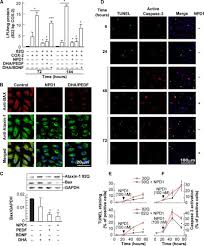 Npo 1 (formerly nederland 1 dutch pronunciation: Ataxin 1 Poly Q Induced Proteotoxic Stress And Apoptosis Are Attenuated In Neural Cells By Docosahexaenoic Acid Derived Neuroprotectin D1 Journal Of Biological Chemistry