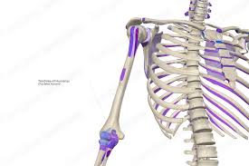 Image result for Trochomeria