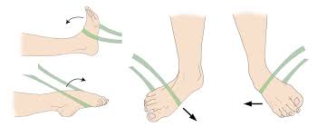 Sprained Ankle - Orthoinfo - Aaos