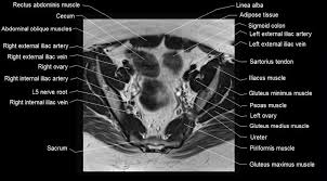 Other pelvic muscles, such as the psoas major and iliacus, serve as flexors. Mri Female Pelvis Anatomy Axial Image 11 Pelvis Anatomy Pelvis Rectus Abdominis Muscle