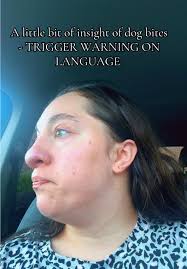 Colton Klein Spokane Dog Attack