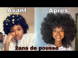 La vitesse de pousse des cheveux dépend de plusieurs facteurs, comme l'âge, le sexe, l'état de santé, l'alimentation ou encore l'ethnie. Evolution Capillaire Mes Erreurs Toutes Mes Astuces Pour Faire Pousser Ses Cheveux Rapidement